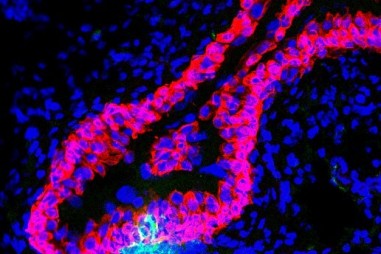 Phát triển vaccine cho bệnh nhiễm trùng đường tiết niệu