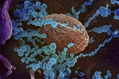 Sóng siêu âm có thể tiêu diệt virus SARS-CoV-2