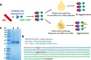 Phát triển bộ test tìm kháng thể chống lại coronavirus với giá rẻ