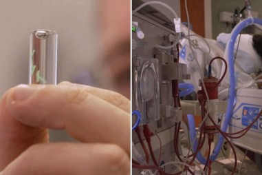 Vi mạch có khả năng phát hiện Covid-19