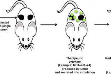 Tế bào T biến đổi diệt ung thư trên diện rộng