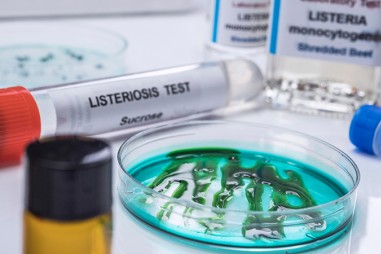 Khám phá listeria mới sẽ cải thiện an toàn thực phẩm
