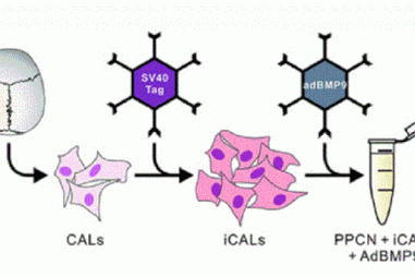 Vật liệu mới tái tạo xương