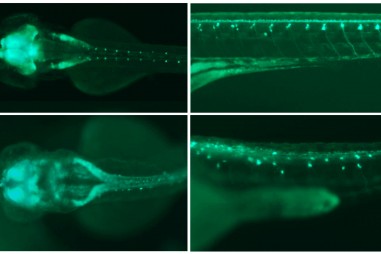 Vai trò quan trọng của gen trong sự phát triển của não bộ