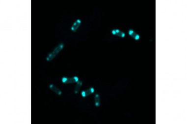 Vũ khí mới trong cuộc chiến chống vi khuẩn kháng kháng sinh