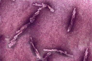 Lý giải về cách bệnh Alzheimer lây lan trong não người