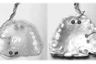 Nghiên cứu đặt nền tảng cho việc phục hồi các chức năng miệng đã mất