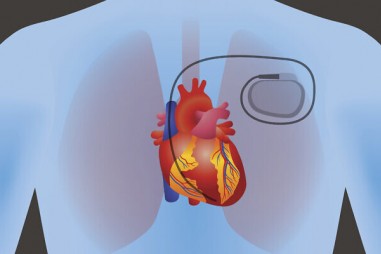 Vật liệu thông minh thúc đẩy việc sản xuất điện trong cơ thể người