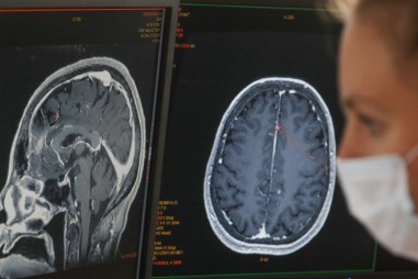 COVID gây hại cho não bộ ra sao