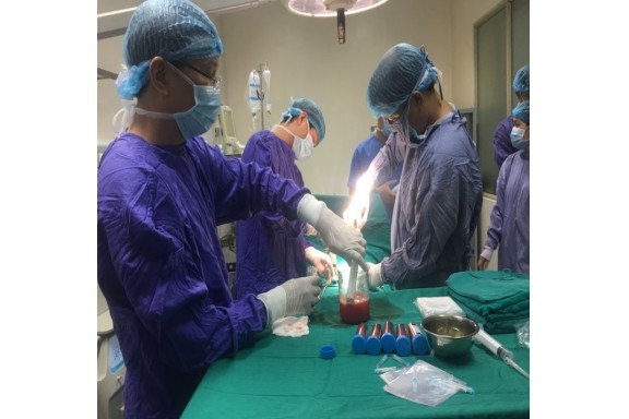 Tế bào gốc tự thân: Phương pháp mới điều trị bệnh đột quỵ não