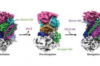 Kính hiển vi tiên tiến giúp các nhà khoa học nhìn thấy cách tế bào phá vỡ protein