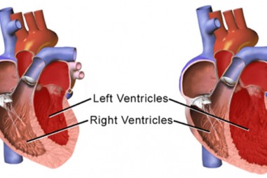 Phát hiện sớm bệnh tim di truyền bằng kỹ thuật giải trình tự gene thế hệ mới