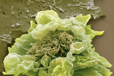 Xác định thêm nhiều biến thể di truyền liên quan đến nguy cơ mắc COVID-19 nặng