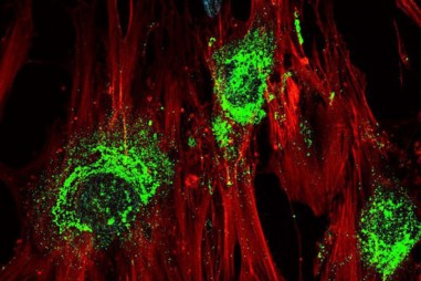 Sóng âm tần số cao biến tế bào gốc thành tế bào xương chỉ trong 5 ngày