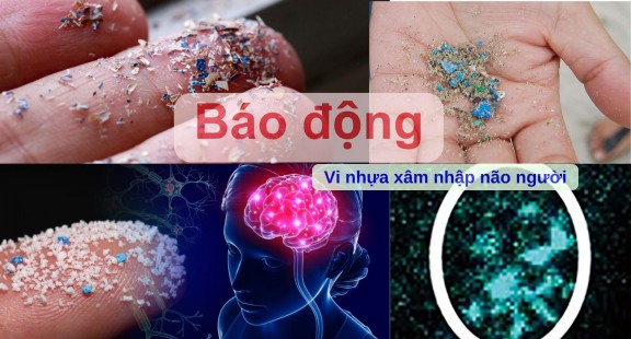 Báo động: Vi nhựa xâm nhập não người với tốc độ nhanh