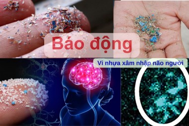 Báo động: Vi nhựa xâm nhập não người với tốc độ nhanh